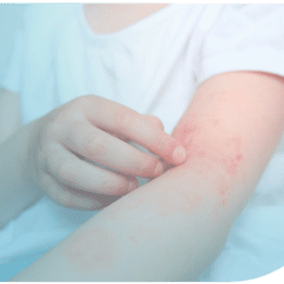 Actualización en dermatitis atópica
