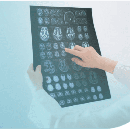 Diagnóstico prenatal de malformaciones cerebrales