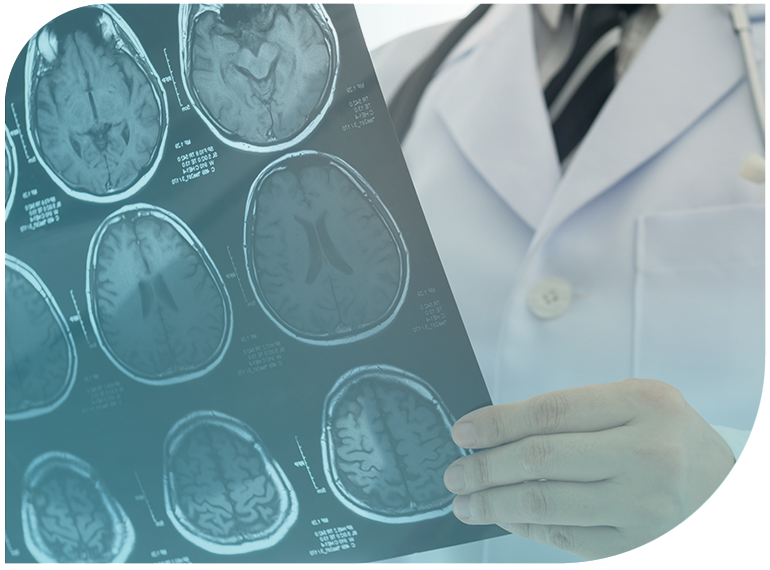 Diagnóstico y tratamiento de tumores neuroendocrinos