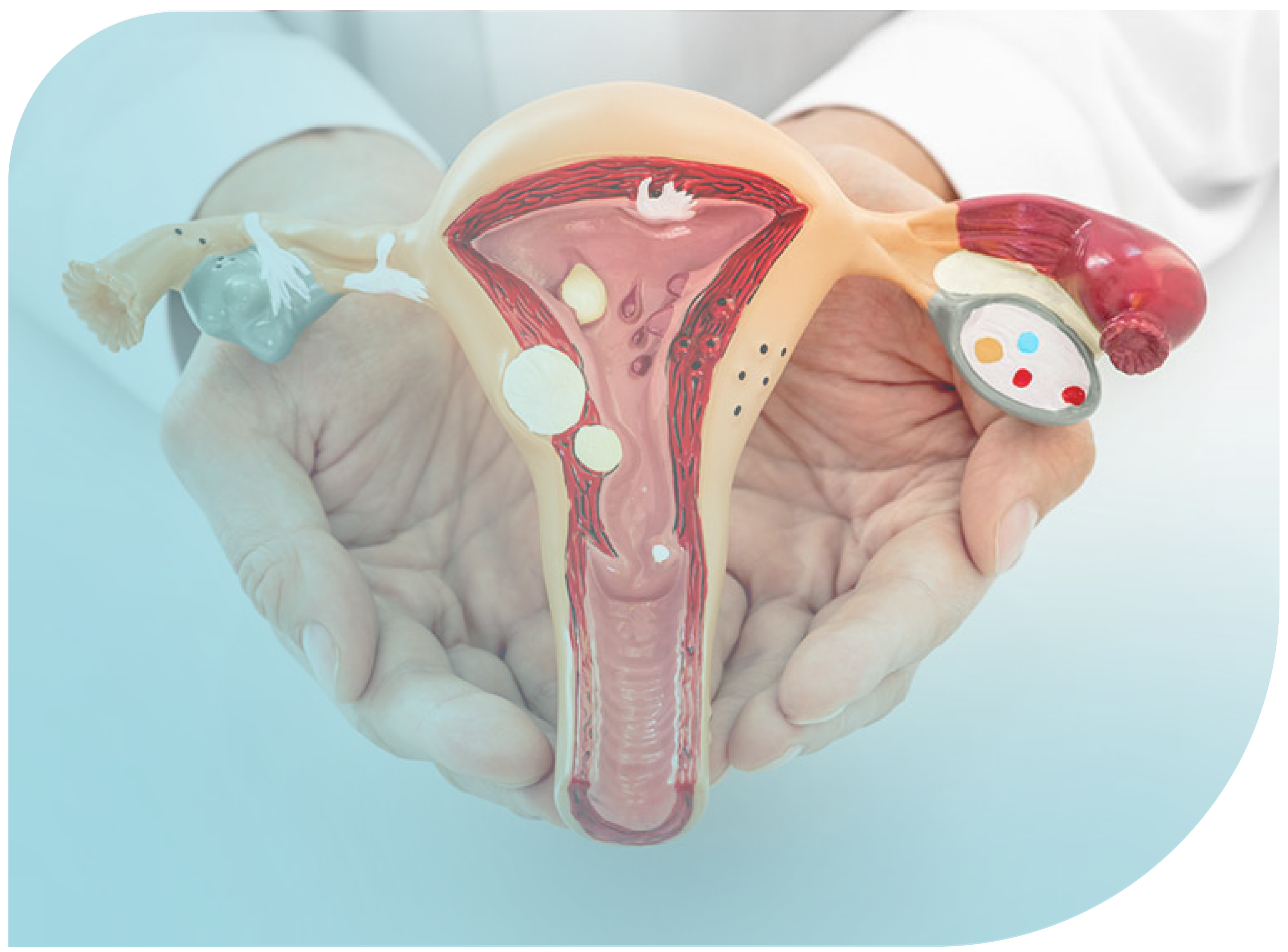 Diagnóstico y tratamiento del cáncer ginecológico