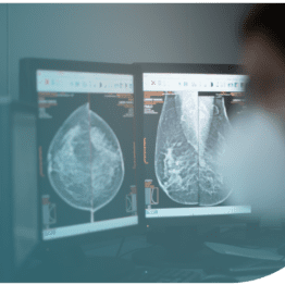 Aspectos diagnósticos radiológicos del cáncer de mama: diagnóstico, herramientas, clasificación TNM