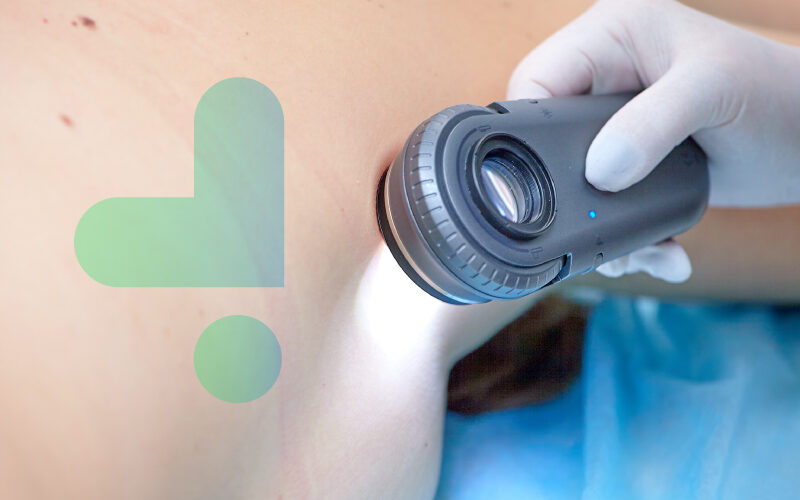 Dermatoscopia digital: aplicaciones en la identificación de enfermedades de la piel