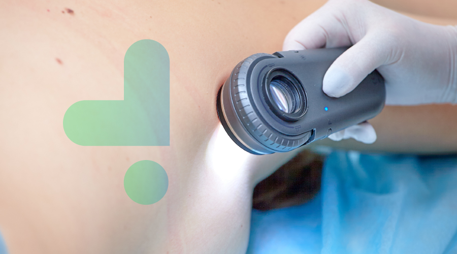 Dermatoscopia digital: aplicaciones en la identificación de enfermedades de la piel