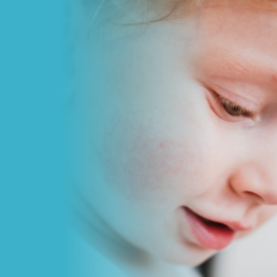 Posgrado en Dermatología Pediátrica: Diagnóstico y Manejo Integral de Enfermedades Cutáneas en Niños
